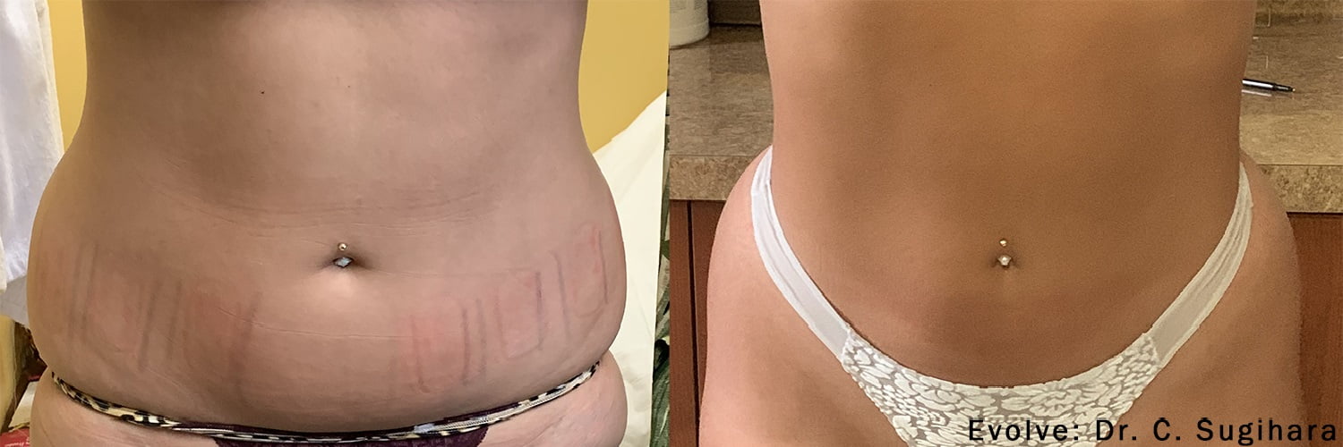 Evolve Before and After - Dr. D. Kiba