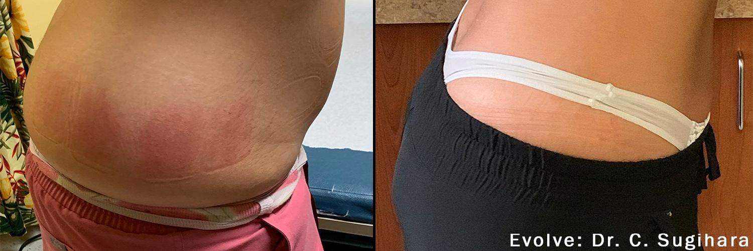 EvolveX Treatments in Collierville, TN